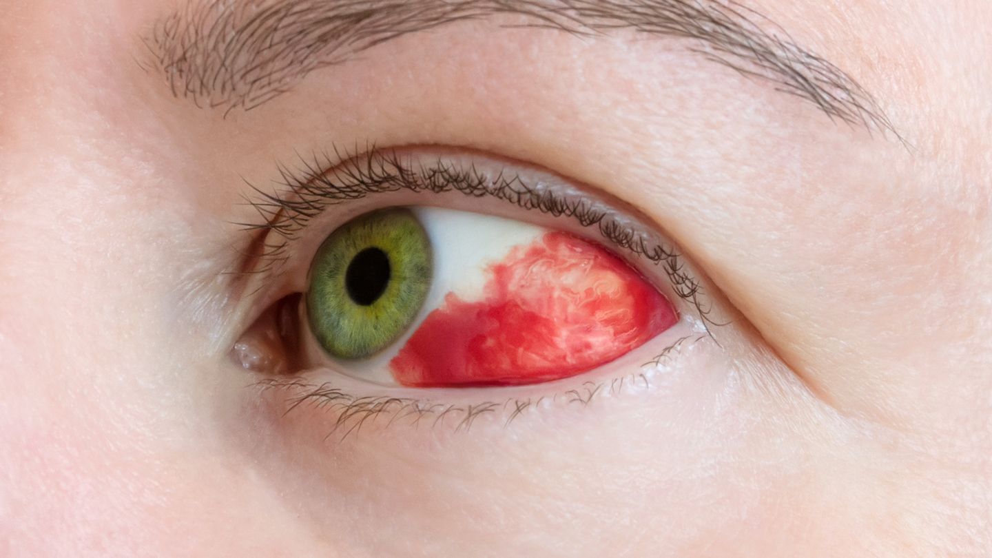 Eye Clinic: Ayzenberg Leonid MD